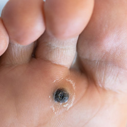A photo of her foot that the client sent to the assistant